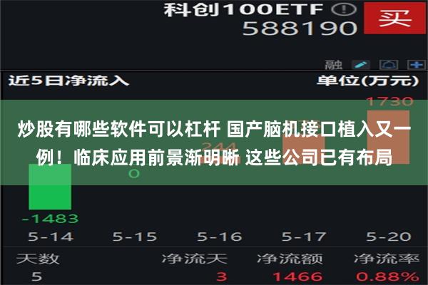 炒股有哪些软件可以杠杆 国产脑机接口植入又一例！临床应用前景渐明晰 这些公司已有布局